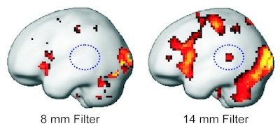 How clear is our view of brain activity? : BCF researchers publish article in "Human Brain Mapping", demonstrating the large influence of filtering algorithms on results in brain imaging How clear is our view of brain activity? : BCF researchers publish article in "Human Brain Mapping", demonstrating the large influence of filtering algorithms on results in brain imaging