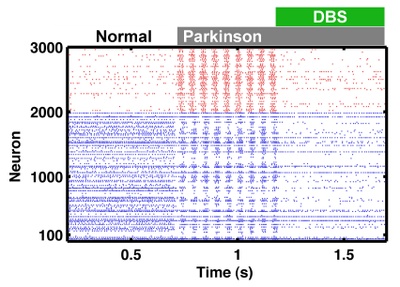 Crippling rhythms of the brain: Network model reveals new insights into causes and possible treatments of Parkinson’s disease Crippling rhythms of the brain: Network model reveals new insights into causes and possible treatments of Parkinson’s disease