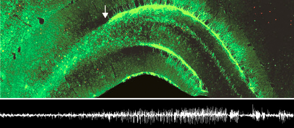 New article in “Cerebral Cortex”: Epileptic state stimulates genesis of nerve cells - Neurogenesis suspected in turn to promote epileptic activity