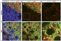 Invasion of the CA2 Region: How sprouting mossy fibers might contribute to epileptic activity