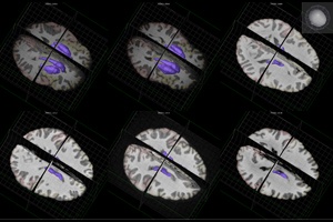 "Should I stay or should I go?" – A newly discovered type of neuron could be the key to understanding why we initiate or inhibit movement "Should I stay or should I go?" – A newly discovered type of neuron could be the key to understanding why we initiate or inhibit movement
