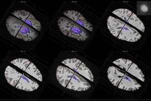 "Should I stay or should I go?" –  A newly discovered type of neuron could be the key to understanding why we initiate or inhibit movement