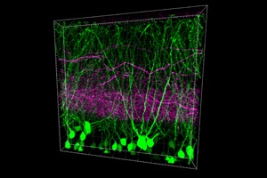 Faulty Connection: Disturbed transmission of signals in the cerebrum promises new findings for epilepsy research