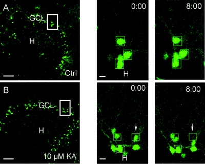 Migration of Dentate Granule Cells in Epilepsy Migration of Dentate Granule Cells in Epilepsy