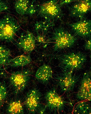 Globalization or Regionalization? How the structural organization of neuronal networks shapes their activity patterns and vice versa Globalization or Regionalization? How the structural organization of neuronal networks shapes their activity patterns and vice versa