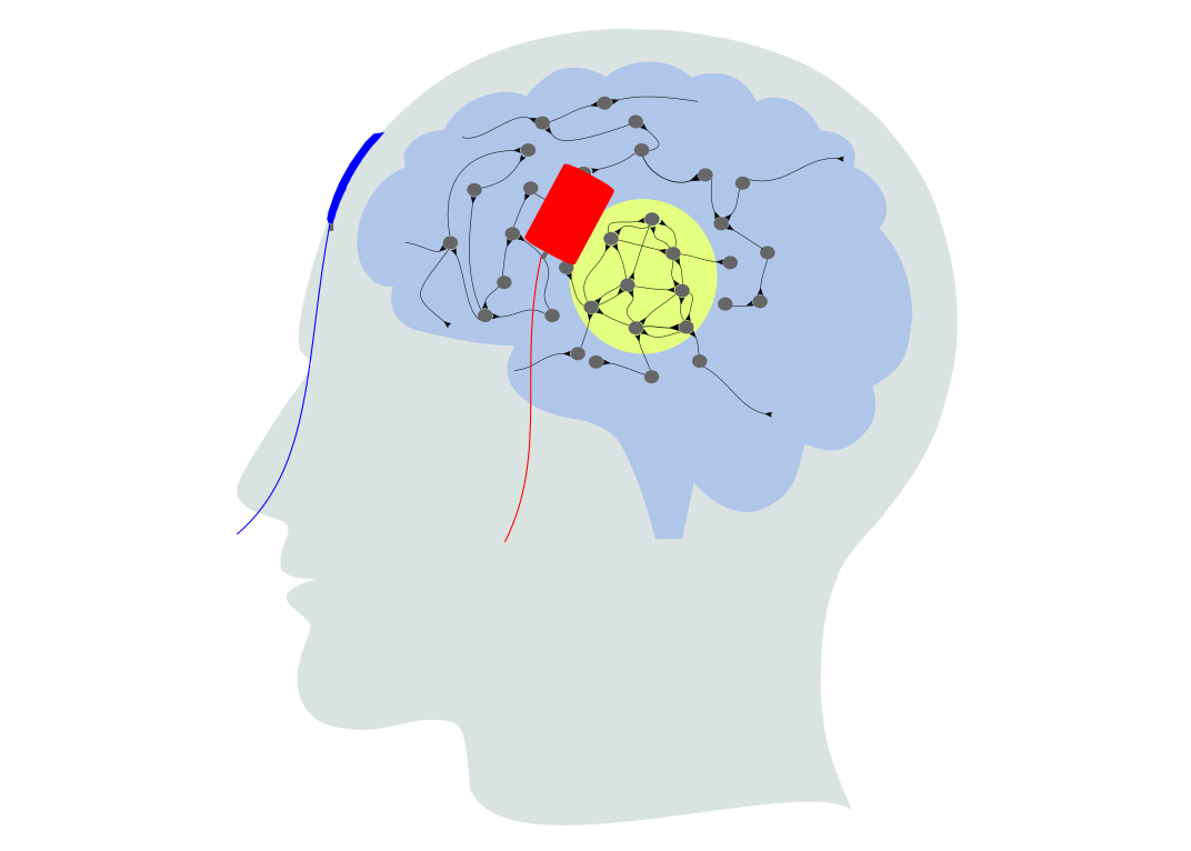Simulating the effect of transcranial brain stimulation