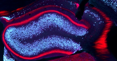Tiefe Hirnstimulation verhindert im Mausmodell epileptische Anfälle Tiefe Hirnstimulation verhindert im Mausmodell epileptische Anfälle
