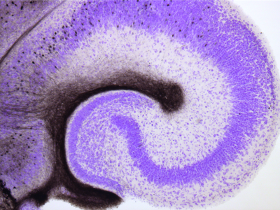 Insights into hippocampal network function Insights into hippocampal network function