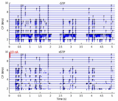 Sign Inversion in a Large Auditory Brainstem Synapse 